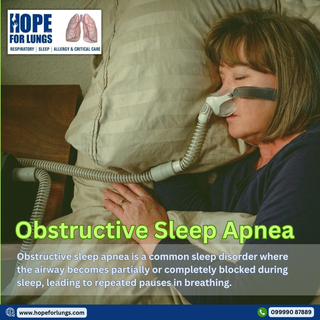 Obstructive sleep apnea